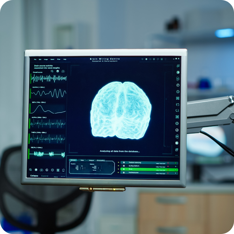 Uno schermo con i dati neurologici di un paziente