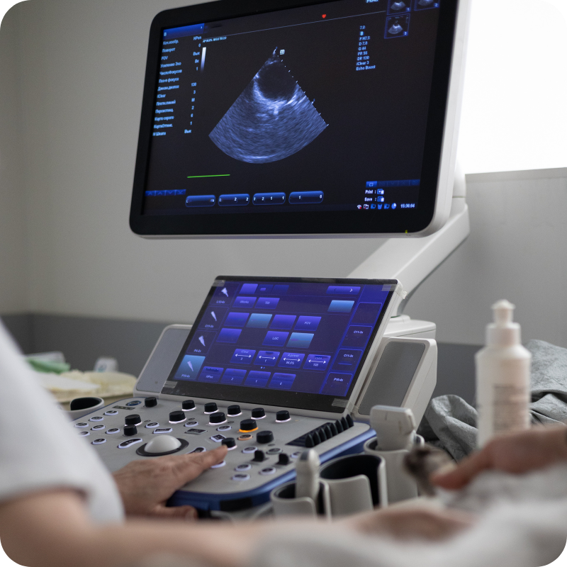 41 L'attrezzatura utilizzata per le ecografie